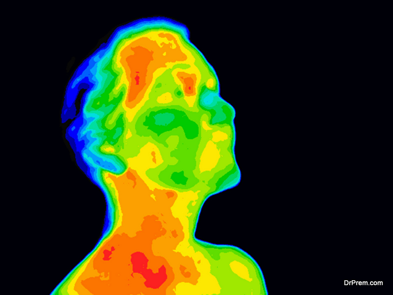 Facial Thermography